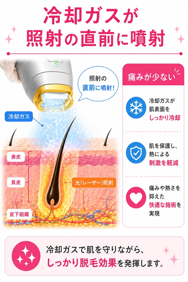 冷却ガスが照射の直前に噴射、痛みが少ない医療脱毛