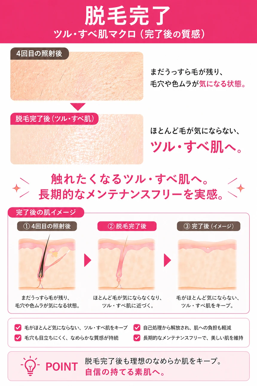 医療脱毛 脱毛完了（ほぼ0%）