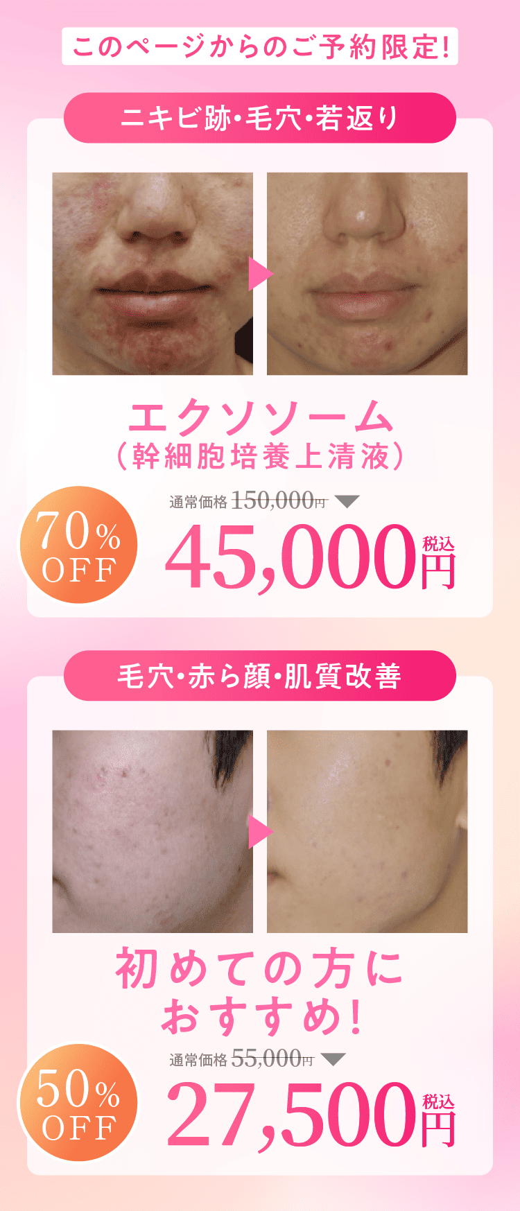 ５名様限定価格55000円