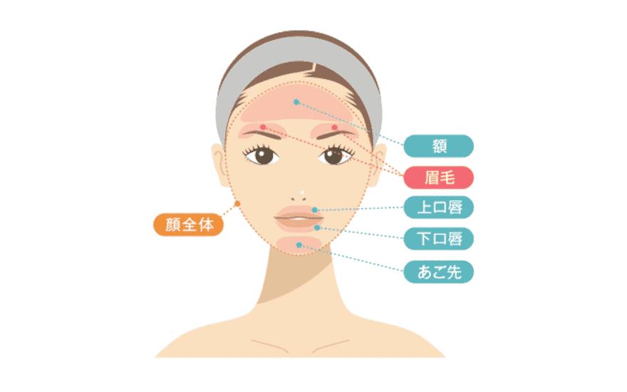 顔脱毛のイメージ図