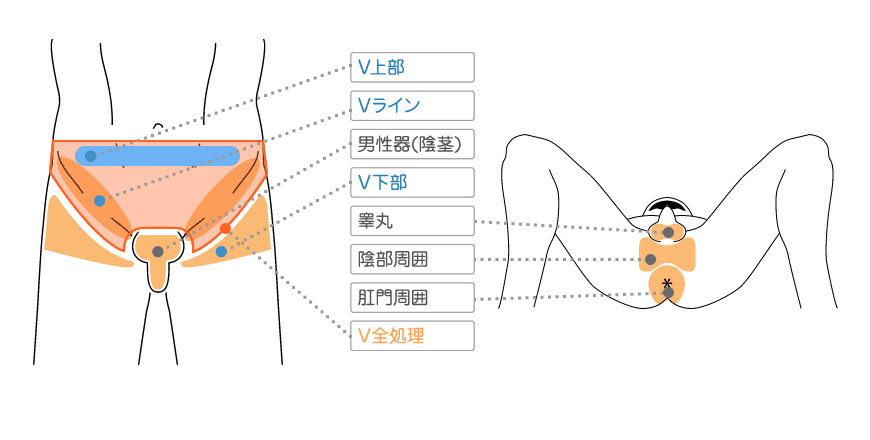 照射部位のパーツサイズ