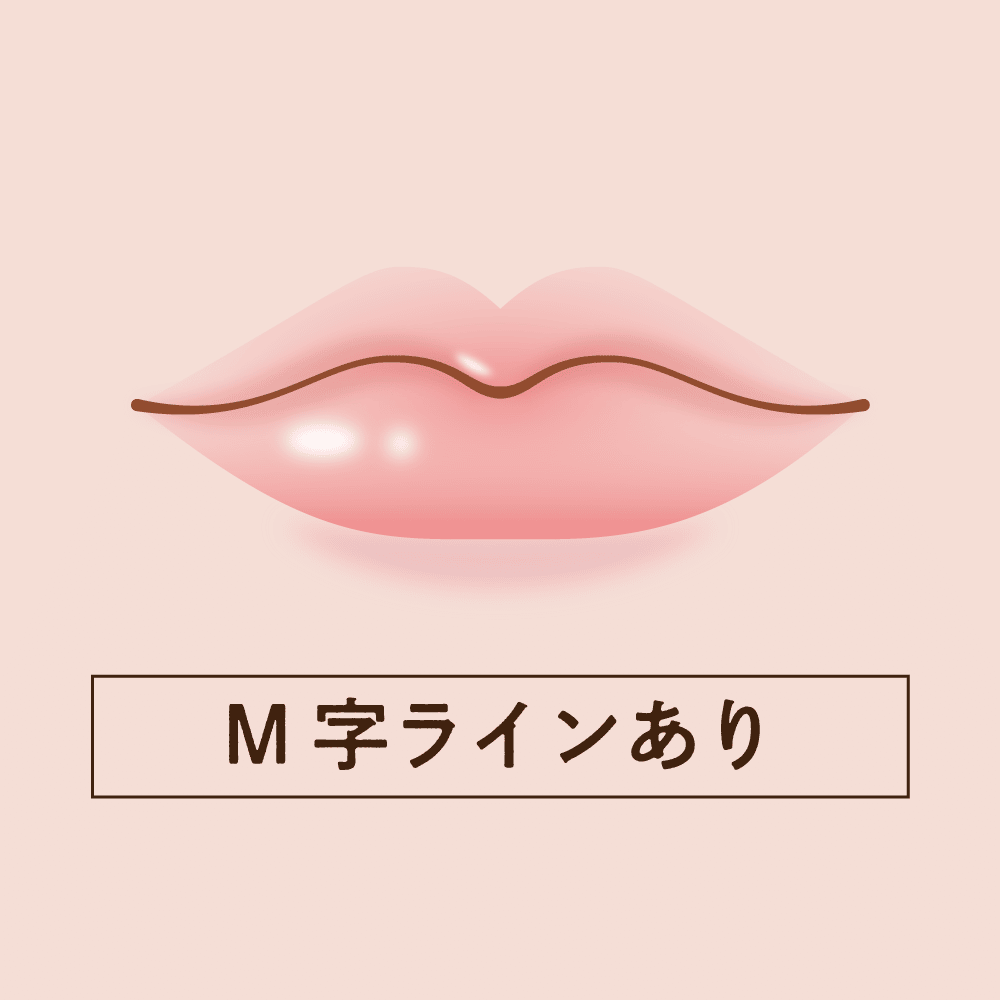 M字ラインありイメージ図